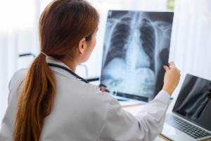 doctor looking at a lung xray